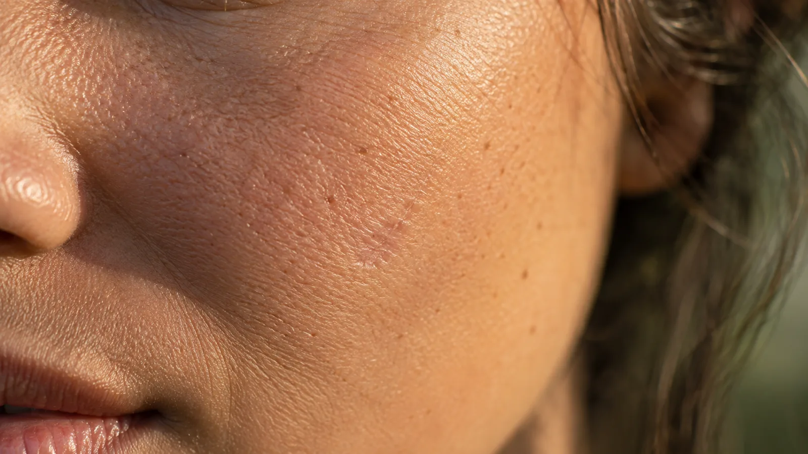Close view of cheek skin texture in warm raking light